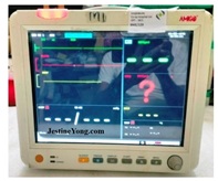 amigo monitor repair